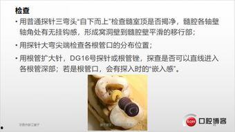 开髓术视频,牙髓治疗技术全解析