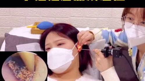 专业掏耳朵的视频,轻松清洁耳朵，享受健康生活